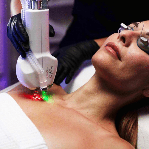 Skin Laser Resurfacing Utah Facial Plastics