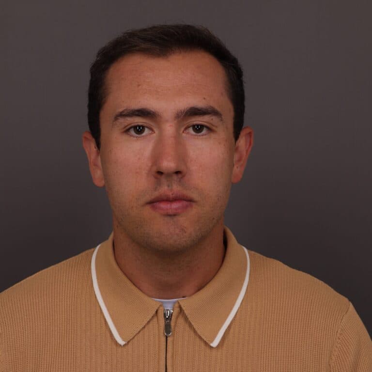 After Image: FUT Hair Transplant, 1500 Grafts - front