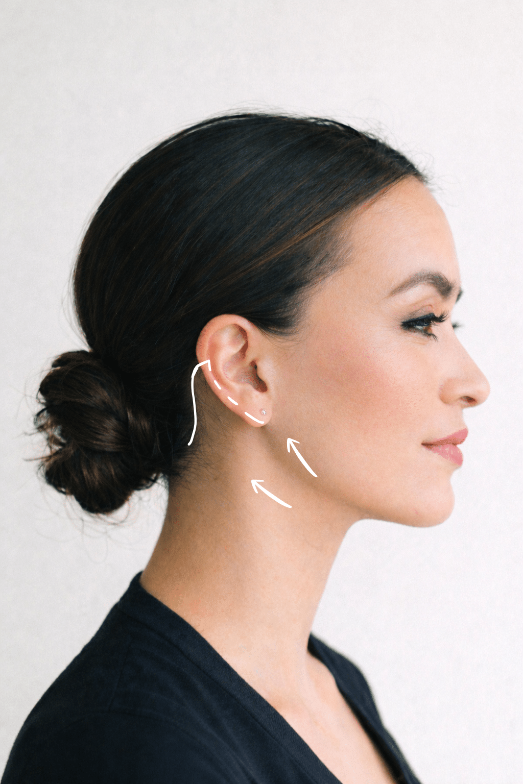 NEW Lower Face Contouring