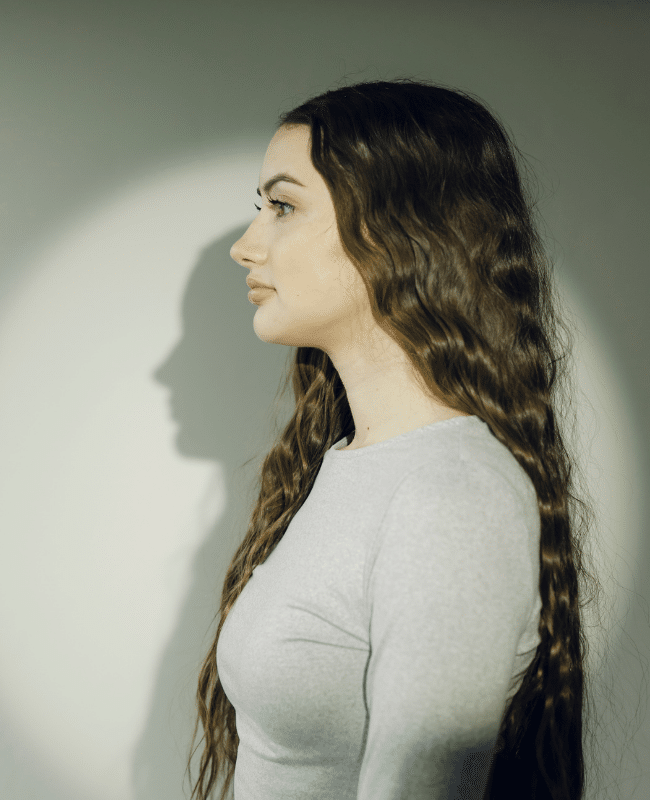 Rhinoplasty at Utah Facial Plastics (2)