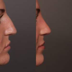 After Image: Bump Shave