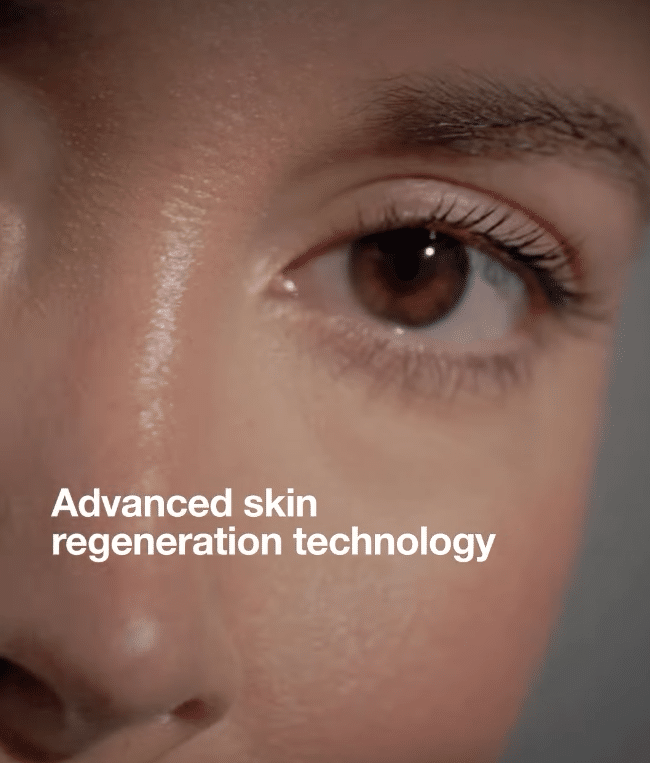 PDRN for Microneedling