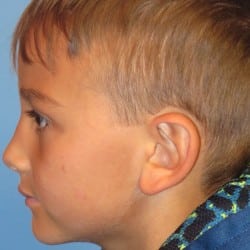 Before Image