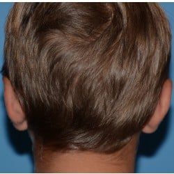 After Image