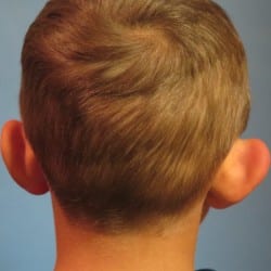 Before Image