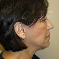 After Image