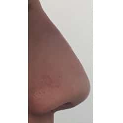 After Image