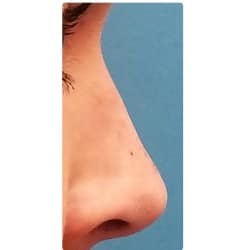 After Image
