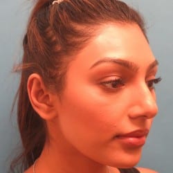 After Image