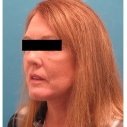 After Image