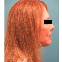 After Image