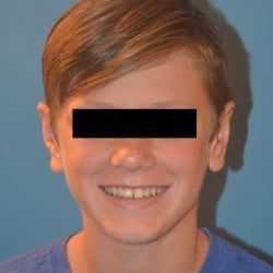 After Image