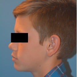 Before Image