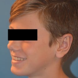 After Image