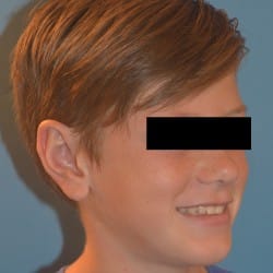 After Image