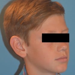 Before Image