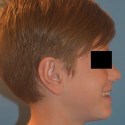 After Image