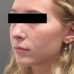 After Image
