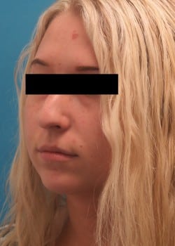 Before Image