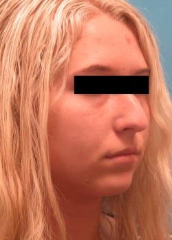 Before Image