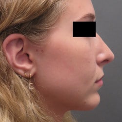 After Image