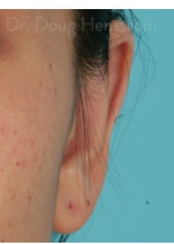 After Image