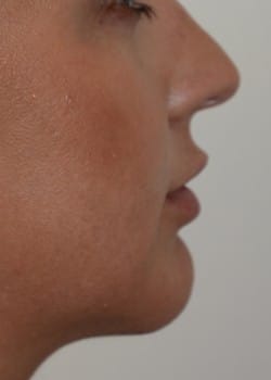 After Image