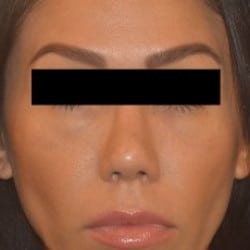 After Image