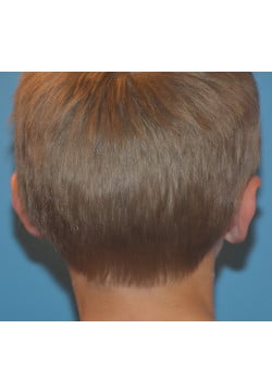 After Image