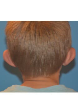 Before Image