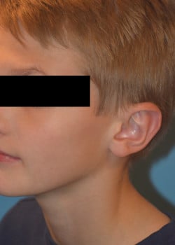 After Image
