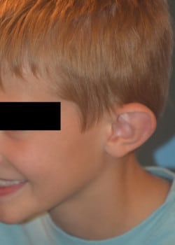 Before Image