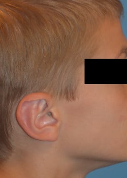 After Image