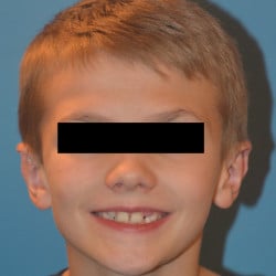 After Image