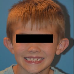 Before Image