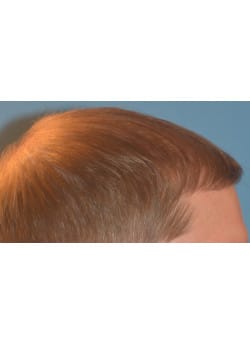 After Image