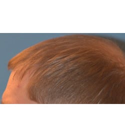 After Image