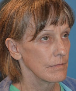 After Image