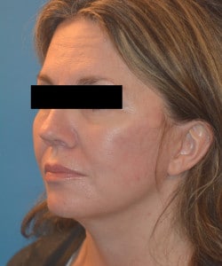 After Image