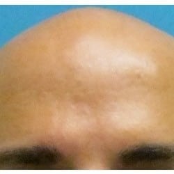 After Image