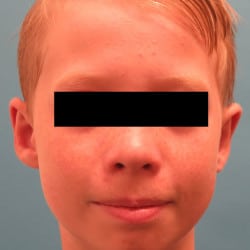 After Image
