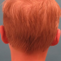 After Image
