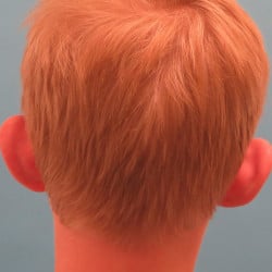 Before Image