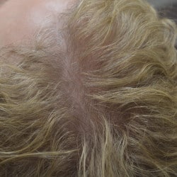 After Image