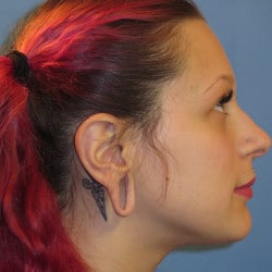 Before Image