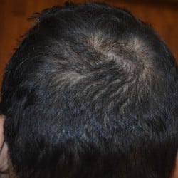 After Image