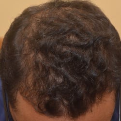 After Image