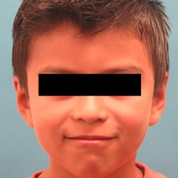 After Image