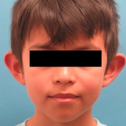Before Image
