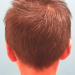 After Image